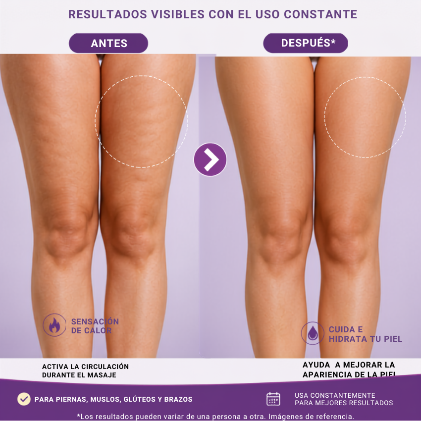 Bye celulitis - Crema criotermica de oro + envío gratis! Paga al recibir.