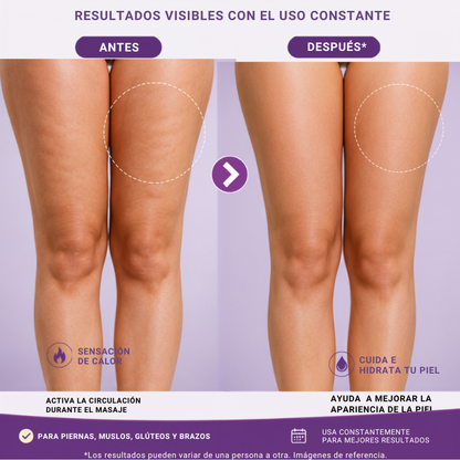 Bye celulitis - Crema criotermica de oro + envío gratis! Paga al recibir.