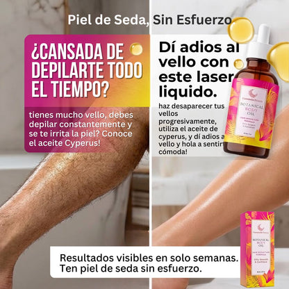 ¡Dile adiós a la depilación y a la irritación con el Aceite Cyperus! | Paga al recibir en casa (envío gratis)